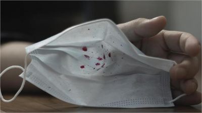 Mystery virus: तेजी से फैल रहा ये वायरस, लोगों को रही है खून की खांसी, एंटीबायोटिक्स भी असरदार नहीं हो रहे